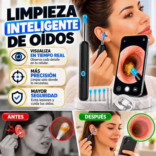 Limpiador de Oídos Inalámbrico NE3 (Wireless Visible Earpick)